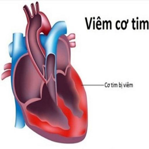 Ep752: VOV - Thời sự 18h (29/10/2019) cover